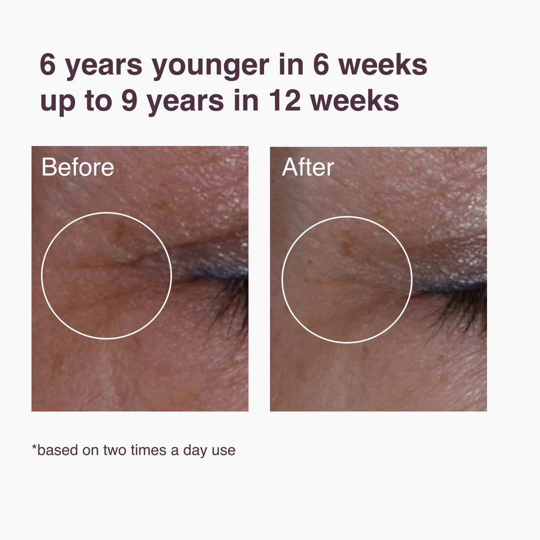 Zombie Cell Serum: resultaat na 6 weken gebruik