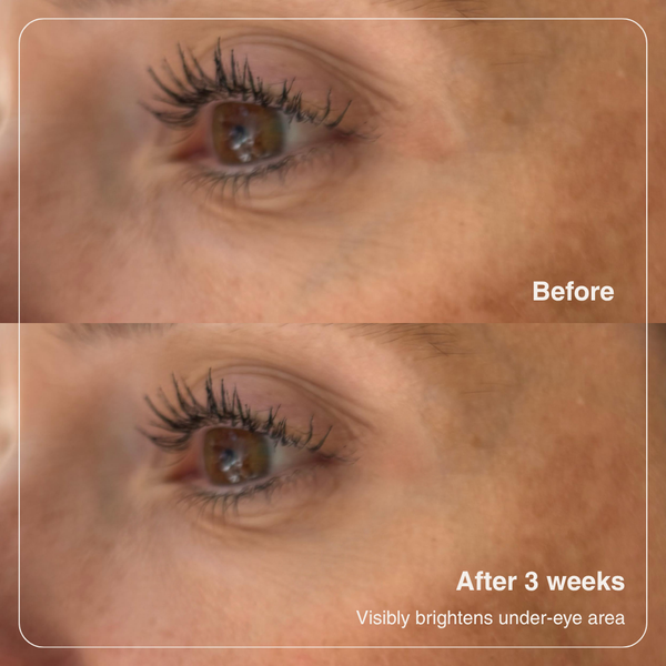 Vitamin K Eye Cream - 15ml